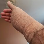postCTSurgery