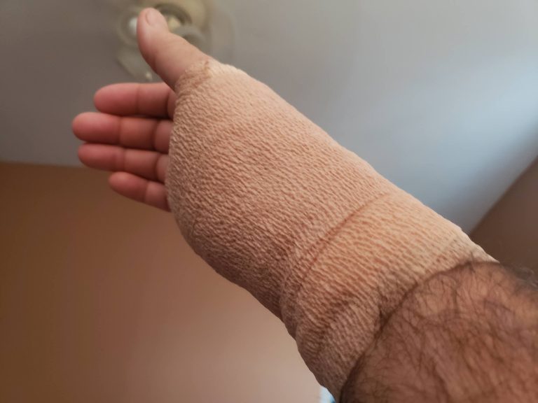 postCTSurgery